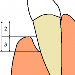 Top Ten Causes of Periodontal Disease